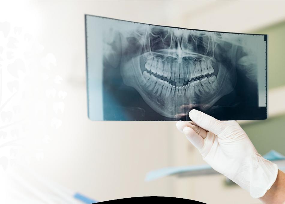 Цифровая ортопантомограмма челюсти: показания и противопоказания.