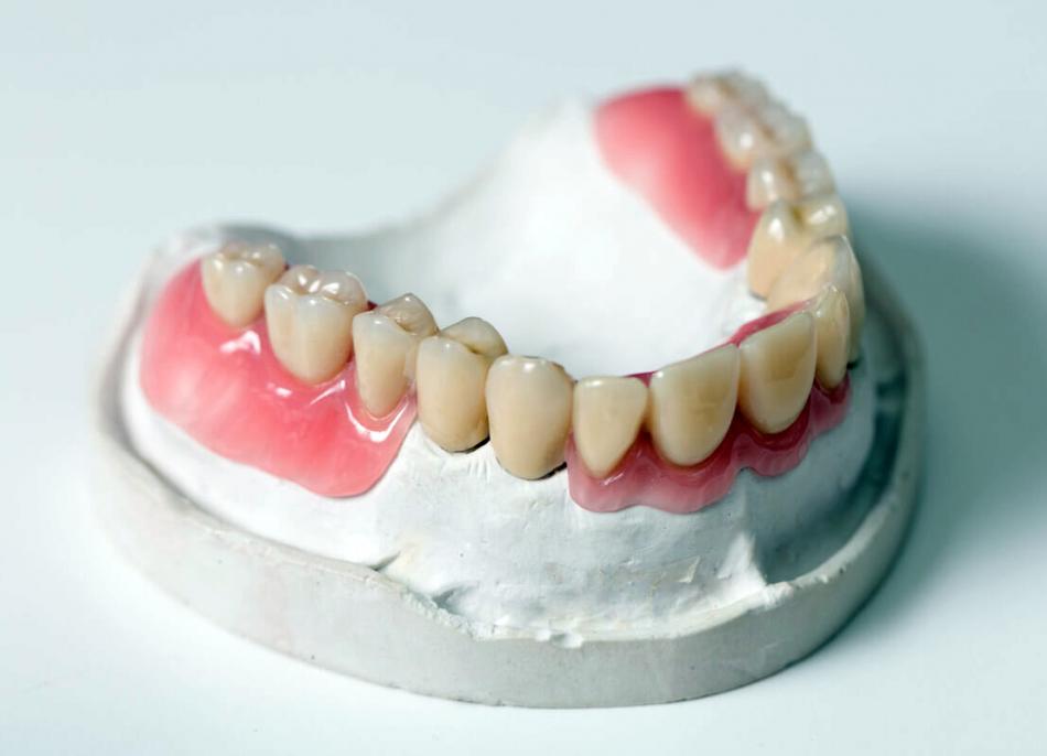 Альтернативные способы протезирования зубов.