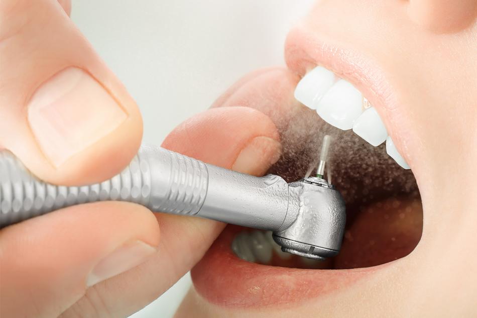 Художественное восстановление зубов: основные методы.