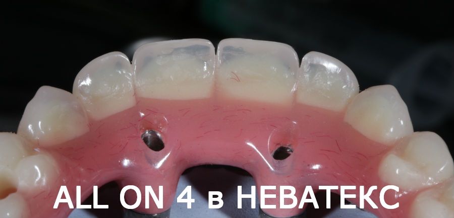 Фотография Неватекс 4