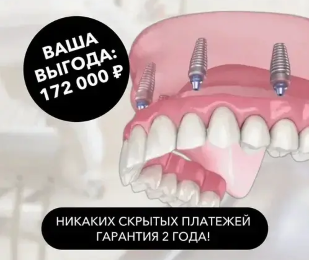 Восстановление зубов на двух челюстях: обычная цена 1106000 > Цена по акции 938000. Ваша выгода 172000 руб.