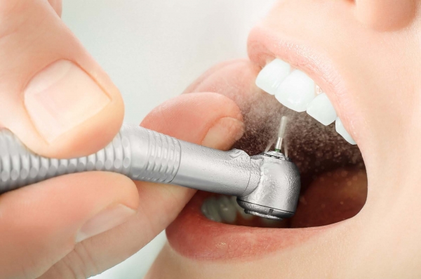 Гигиена полости рта (Airflow, ультразвук, фторирование) - 4 000 р.
