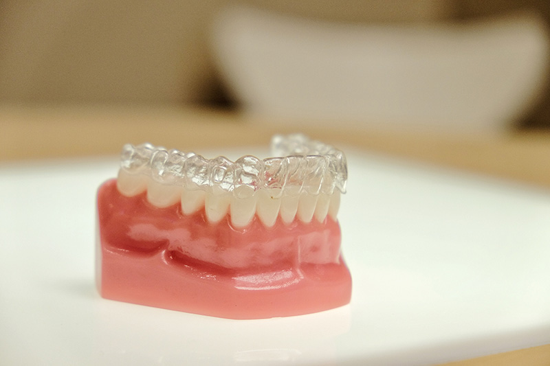 Цена на зубные ретейнеры в стоматологии.