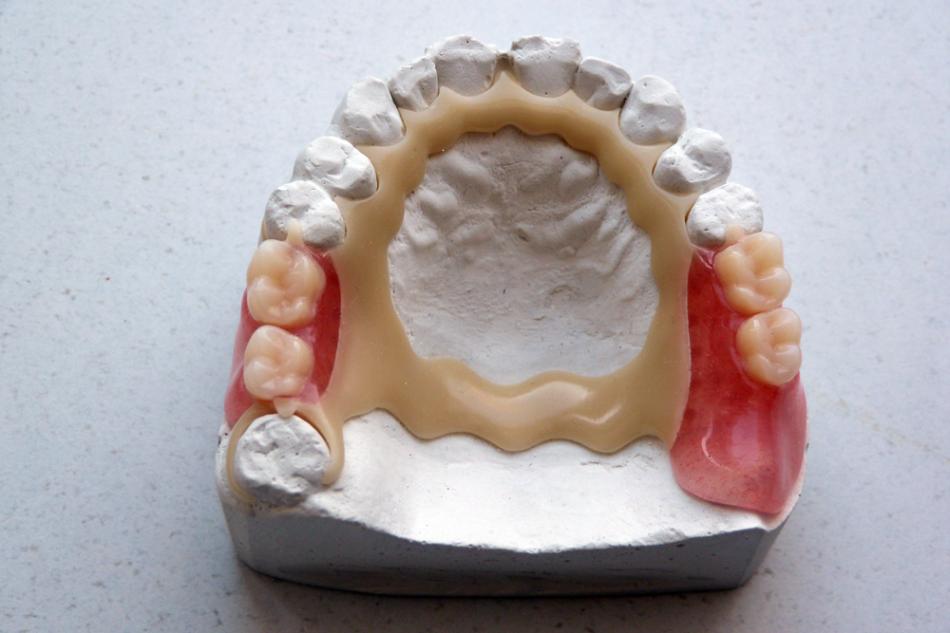 Сколько стоит протез Квадротти в стоматологии?