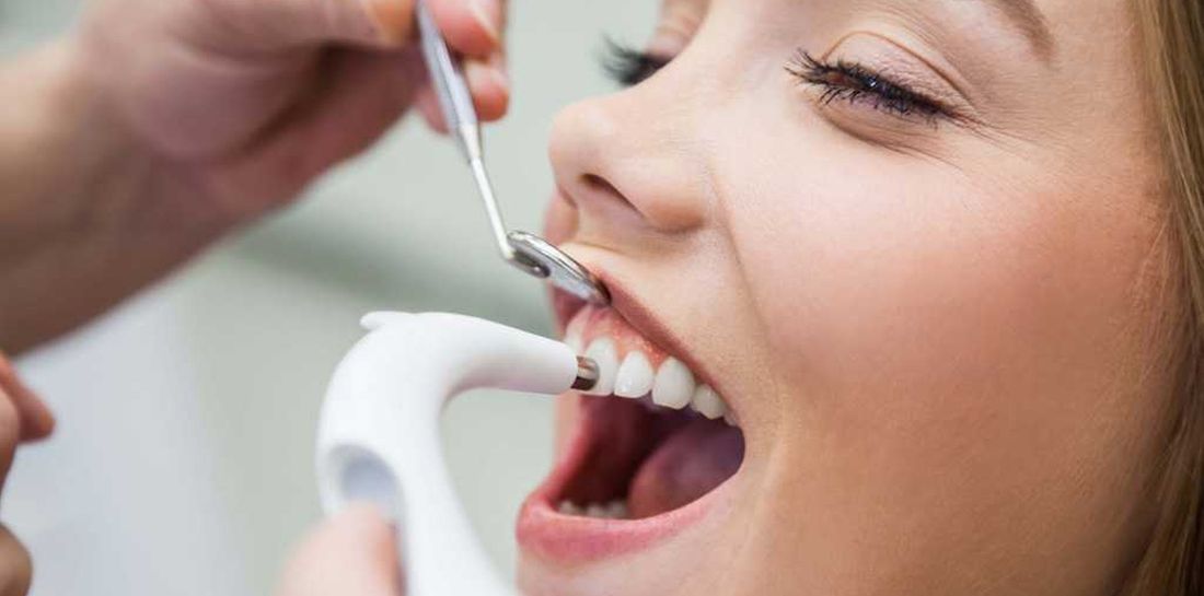 Сколько стоит профессиональная чистка зубов у стоматолога?