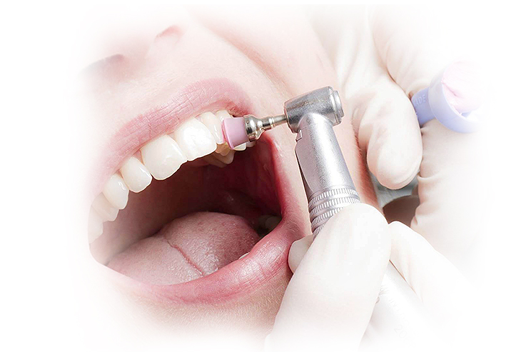 Профессиональная чистка зубов у стоматолога.