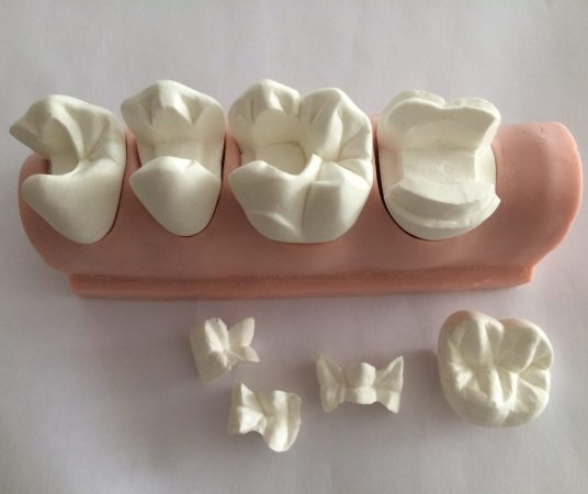 Основные методы микропротезирования зубов.