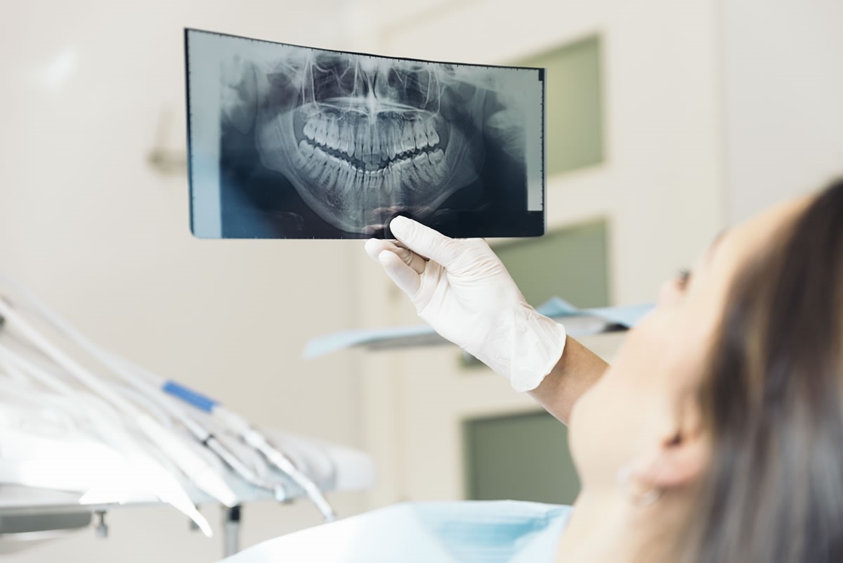 Когда нужно делать рентген зубов?