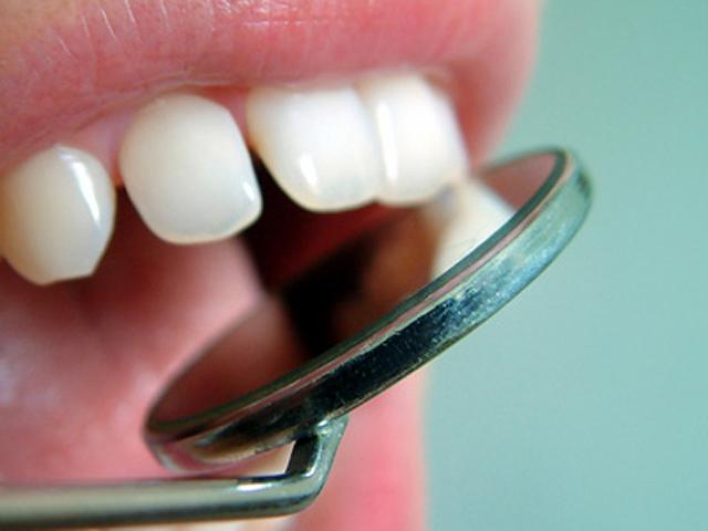 Польза и вред от процедуры серебрения детских зубов.