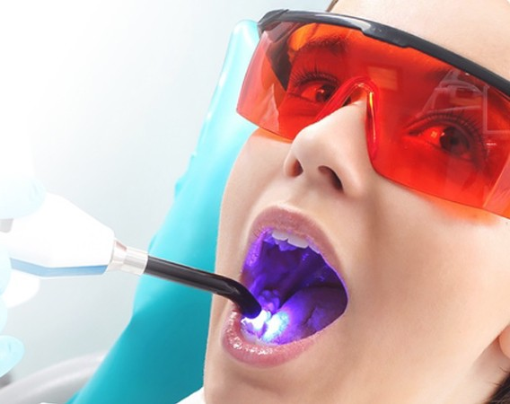 Как делают лазерное отбеливание зубов в стоматологии?