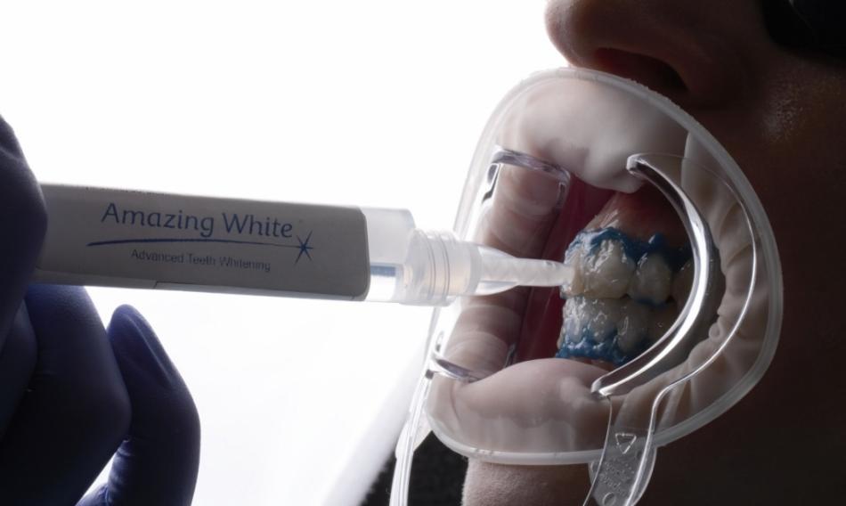 Кабинетное отбеливание зубов Amazing White.