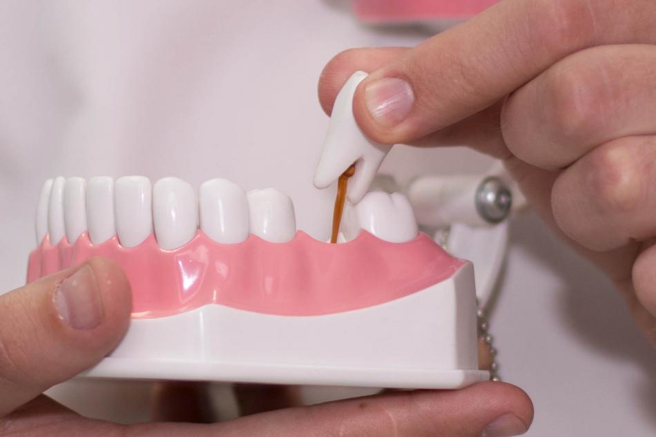 Когда нужна консультация стоматолога-ортопеда?