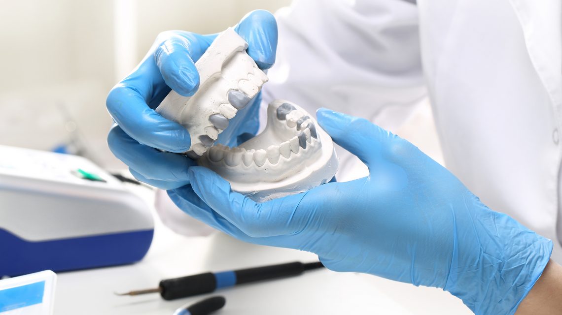 Ремонт зубных протезов в стоматологии.