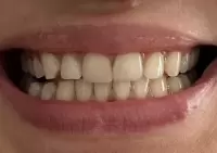 Юна Егорова, изображение к комментарию.