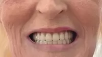 Опасно Огонь, изображение к комментарию.