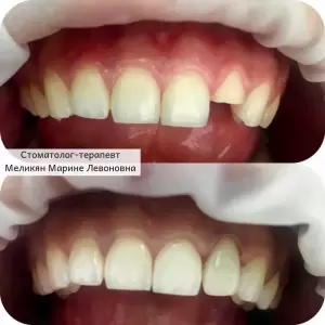 Фотография Дента-Люкс 1