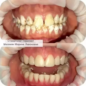 Фотография Дента-Люкс 4