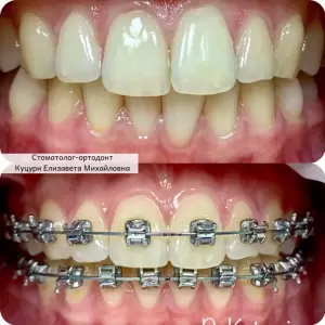 Фотография Дента-Люкс 3