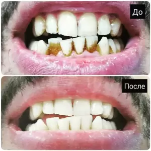 Фотография Дента-Люкс 2